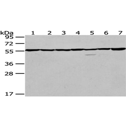 PRPF19 Antibody from Signalway Antibody (43084) - Antibodies.com