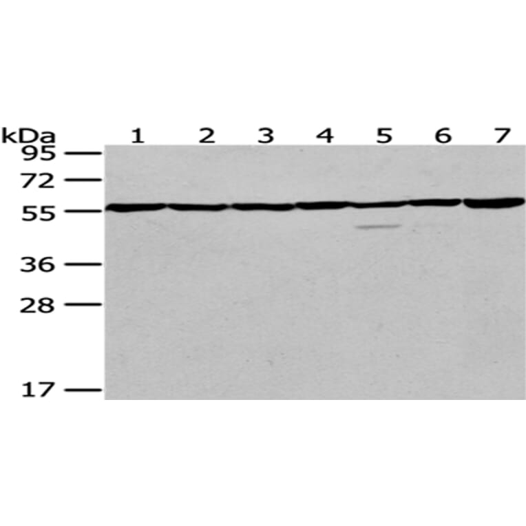 PRPF19 Antibody from Signalway Antibody (43084) - Antibodies.com
