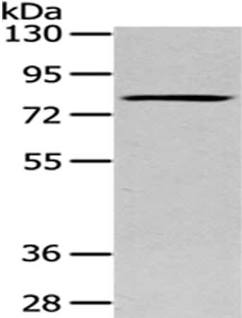 Gel: 6%SDS-PAGE Lysate: 40 &#956;g Lane: Jurkat cell Primary antibody: 1/400 dilution Secondary antibody: Goat anti rabbit IgG at 1/8000 dilution Exposure time: 30 seconds