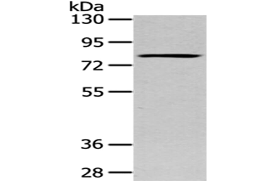 SETMAR Antibody from Signalway Antibody (43086) - Antibodies.com