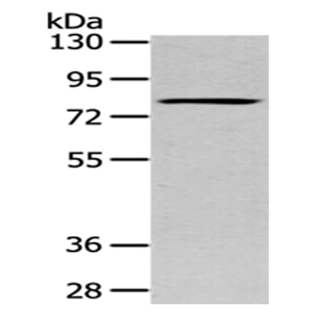 SETMAR Antibody from Signalway Antibody (43086) - Antibodies.com