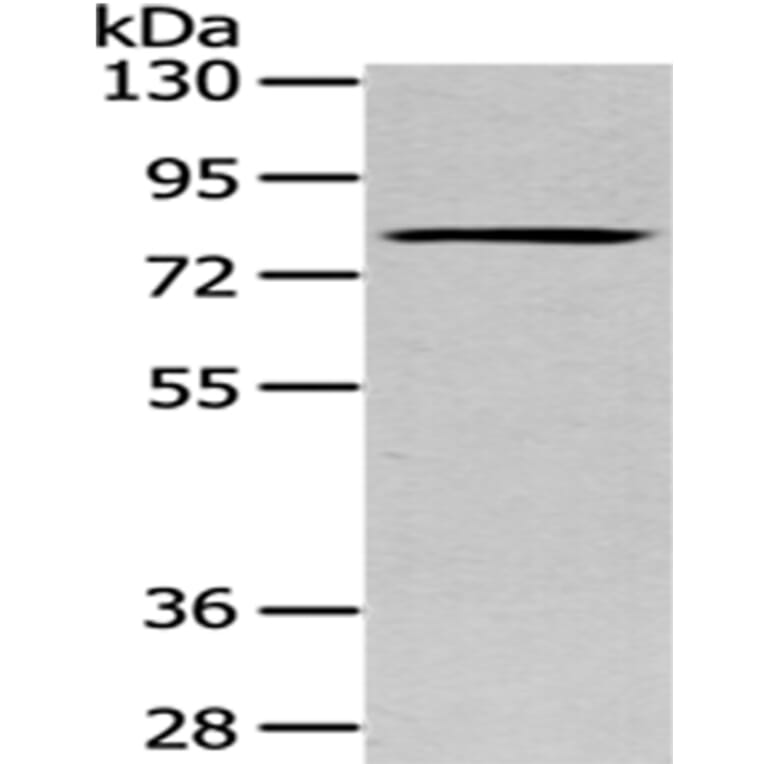 SETMAR Antibody from Signalway Antibody (43086) - Antibodies.com