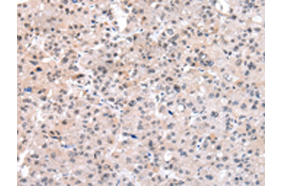 Immunohistochemistry - SETMAR Antibody from Signalway Antibody (43086) - Antibodies.com