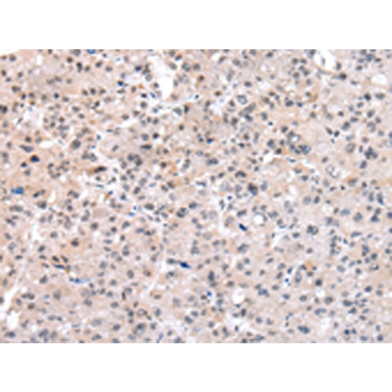 Immunohistochemistry - SETMAR Antibody from Signalway Antibody (43086) - Antibodies.com