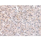 Immunohistochemistry - SETMAR Antibody from Signalway Antibody (43086) - Antibodies.com