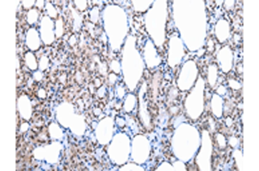 Immunohistochemistry - SETMAR Antibody from Signalway Antibody (43086) - Antibodies.com