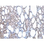 Immunohistochemistry - SETMAR Antibody from Signalway Antibody (43086) - Antibodies.com