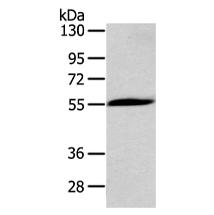 CHRNA1 Antibody from Signalway Antibody (43098) - Antibodies.com