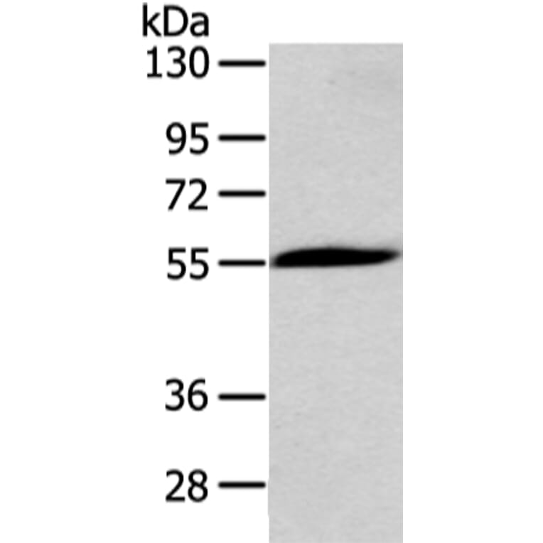 CHRNA1 Antibody from Signalway Antibody (43098) - Antibodies.com