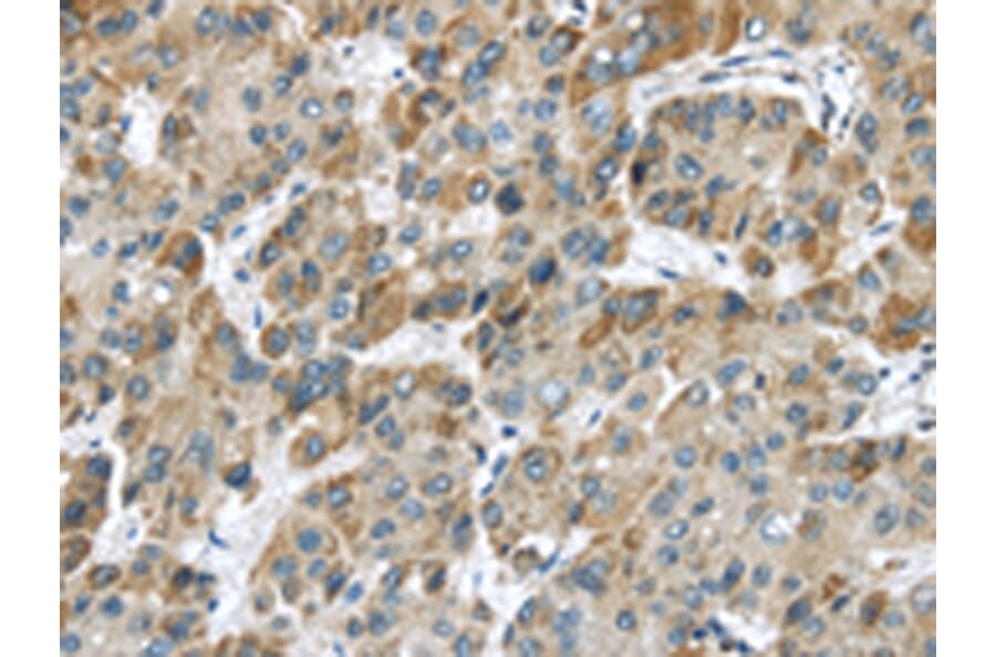 Immunohistochemistry - CHRNA1 Antibody from Signalway Antibody (43098) - Antibodies.com