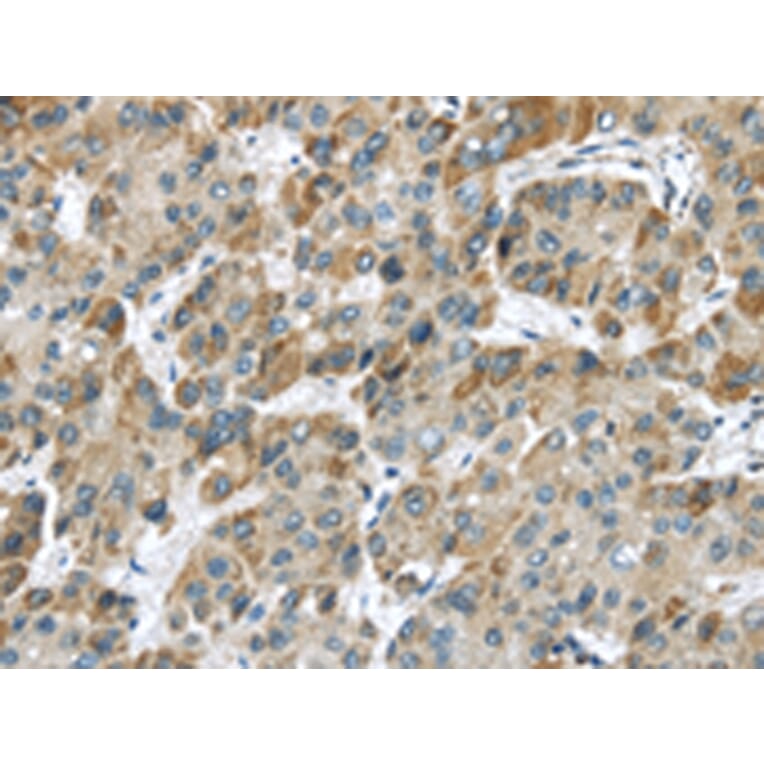 Immunohistochemistry - CHRNA1 Antibody from Signalway Antibody (43098) - Antibodies.com