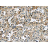 Immunohistochemistry - CHRNA1 Antibody from Signalway Antibody (43098) - Antibodies.com