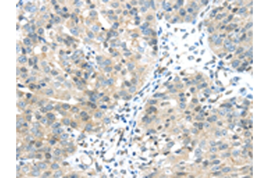Immunohistochemistry - CHRNA1 Antibody from Signalway Antibody (43098) - Antibodies.com
