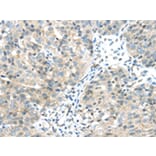 Immunohistochemistry - CHRNA1 Antibody from Signalway Antibody (43098) - Antibodies.com