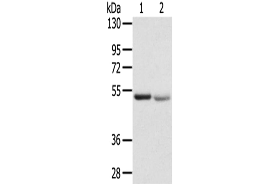 SLC8B1 Antibody from Signalway Antibody (43144) - Antibodies.com