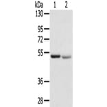 SLC8B1 Antibody from Signalway Antibody (43144) - Antibodies.com
