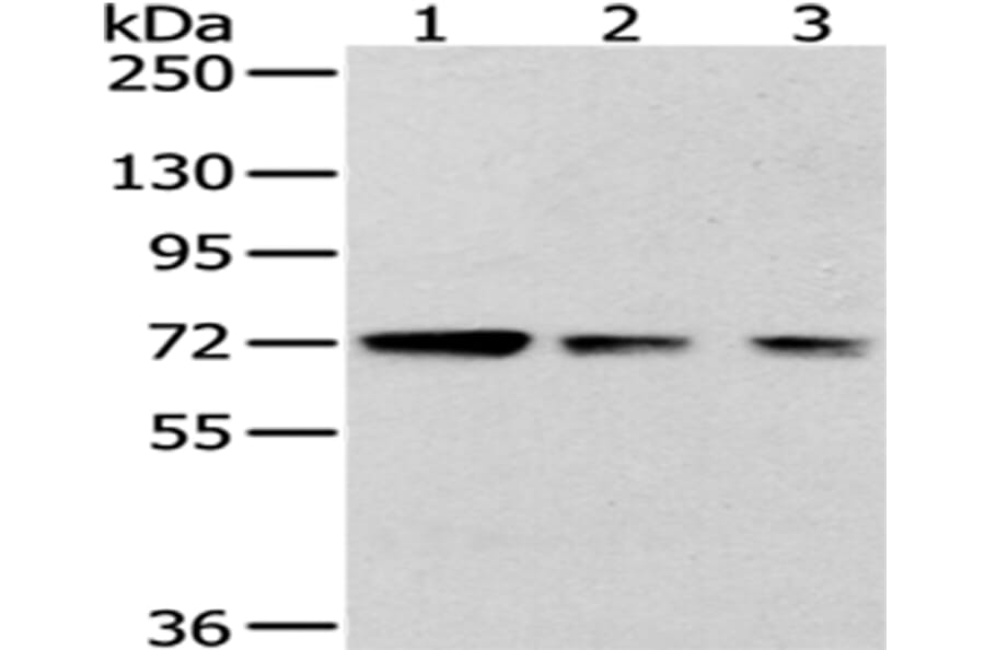 HNRNPM Antibody from Signalway Antibody (43188) - Antibodies.com