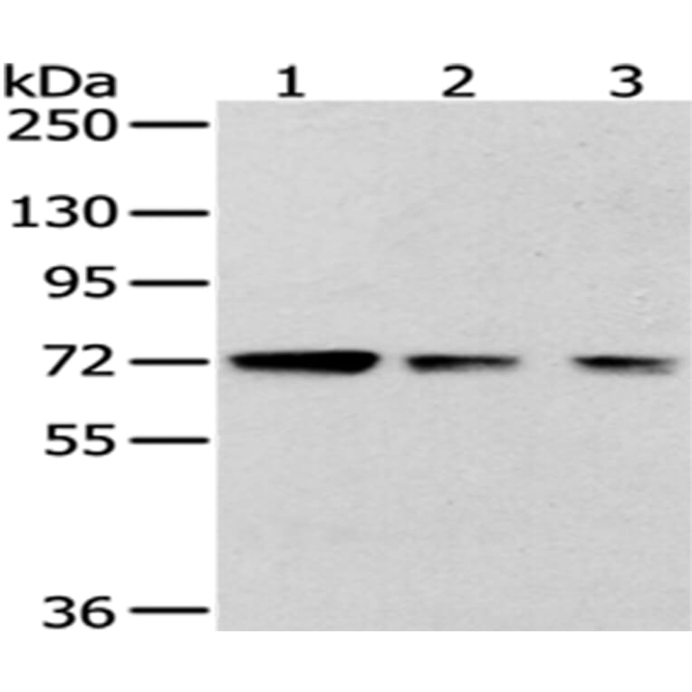 HNRNPM Antibody from Signalway Antibody (43188) - Antibodies.com