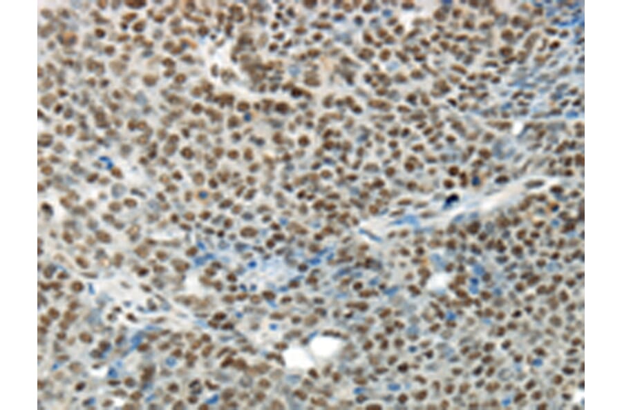 Immunohistochemistry - HNRNPM Antibody from Signalway Antibody (43188) - Antibodies.com