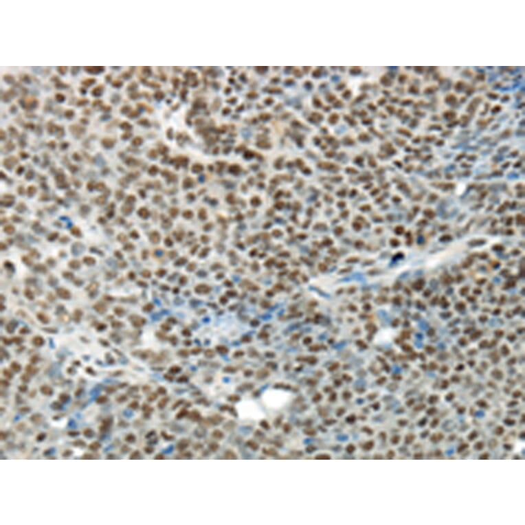 Immunohistochemistry - HNRNPM Antibody from Signalway Antibody (43188) - Antibodies.com