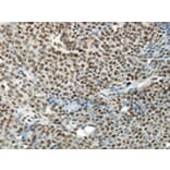 Immunohistochemistry - HNRNPM Antibody from Signalway Antibody (43188) - Antibodies.com