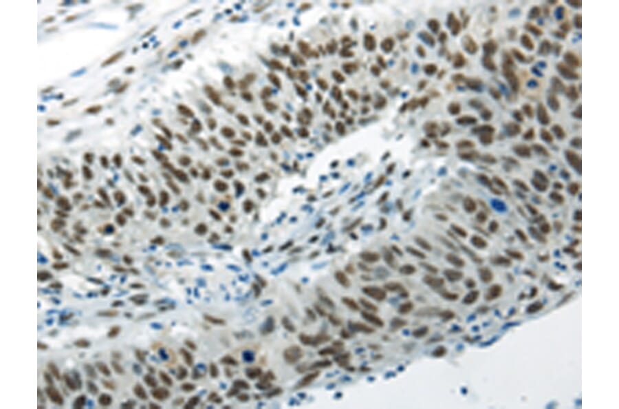 Immunohistochemistry - HNRNPM Antibody from Signalway Antibody (43188) - Antibodies.com