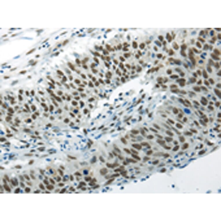 Immunohistochemistry - HNRNPM Antibody from Signalway Antibody (43188) - Antibodies.com