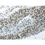 Immunohistochemistry - HNRNPM Antibody from Signalway Antibody (43188) - Antibodies.com