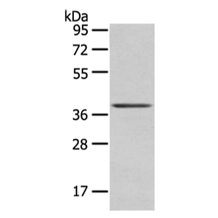 WNT10A Antibody from Signalway Antibody (43194) - Antibodies.com