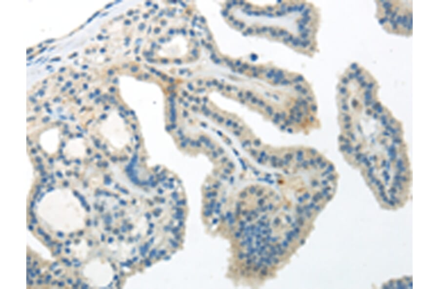 Immunohistochemistry - WNT10A Antibody from Signalway Antibody (43194) - Antibodies.com