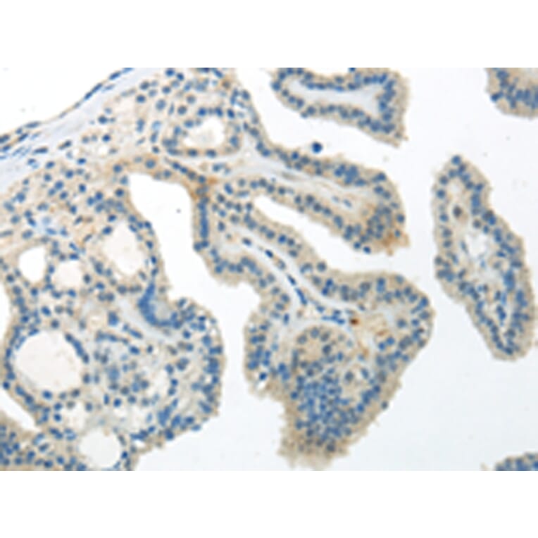 Immunohistochemistry - WNT10A Antibody from Signalway Antibody (43194) - Antibodies.com