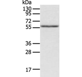 ACVRL1 Antibody from Signalway Antibody (43246) - Antibodies.com