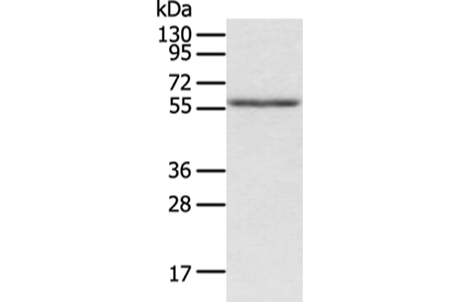 ACVRL1 Antibody from Signalway Antibody (43246) - Antibodies.com
