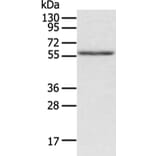 ACVRL1 Antibody from Signalway Antibody (43246) - Antibodies.com