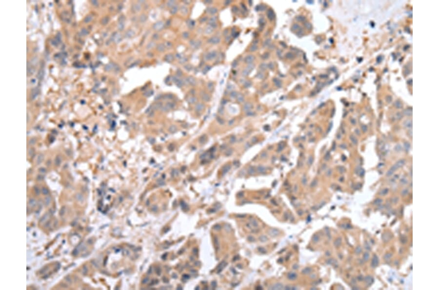 Immunohistochemistry - ACVRL1 Antibody from Signalway Antibody (43246) - Antibodies.com