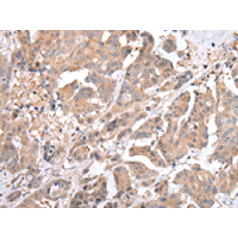 Immunohistochemistry - ACVRL1 Antibody from Signalway Antibody (43246) - Antibodies.com