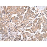 Immunohistochemistry - ACVRL1 Antibody from Signalway Antibody (43246) - Antibodies.com