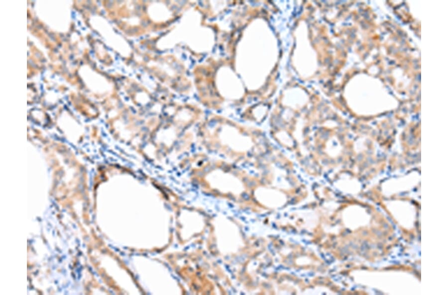 Immunohistochemistry - ACVRL1 Antibody from Signalway Antibody (43246) - Antibodies.com