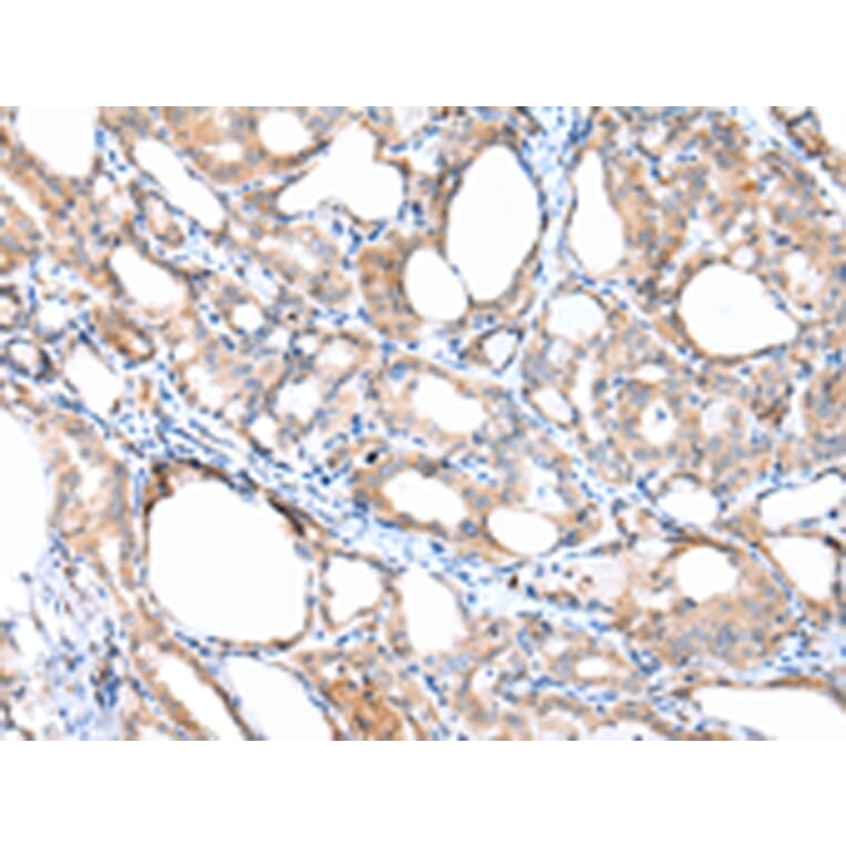 Immunohistochemistry - ACVRL1 Antibody from Signalway Antibody (43246) - Antibodies.com
