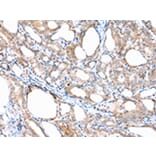 Immunohistochemistry - ACVRL1 Antibody from Signalway Antibody (43246) - Antibodies.com