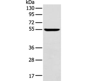 FOXG1 Antibody from Signalway Antibody (43265) - Antibodies.com
