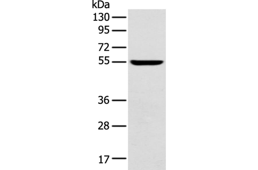 FOXG1 Antibody from Signalway Antibody (43265) - Antibodies.com