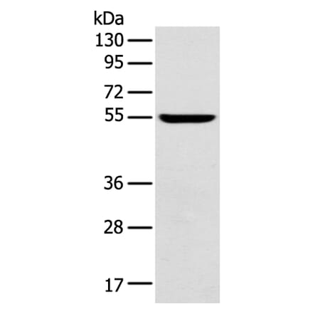 FOXG1 Antibody from Signalway Antibody (43265) - Antibodies.com