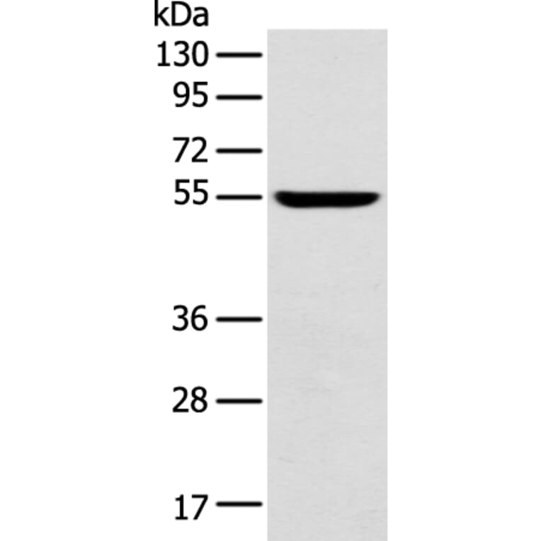 FOXG1 Antibody from Signalway Antibody (43265) - Antibodies.com