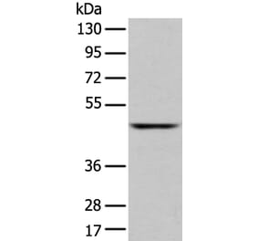 SLC2A6 Antibody from Signalway Antibody (43276) - Antibodies.com