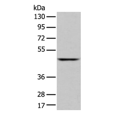 SLC2A6 Antibody from Signalway Antibody (43276) - Antibodies.com