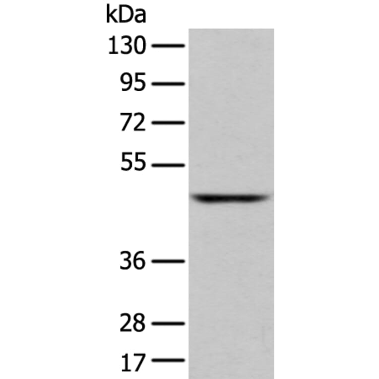 SLC2A6 Antibody from Signalway Antibody (43276) - Antibodies.com