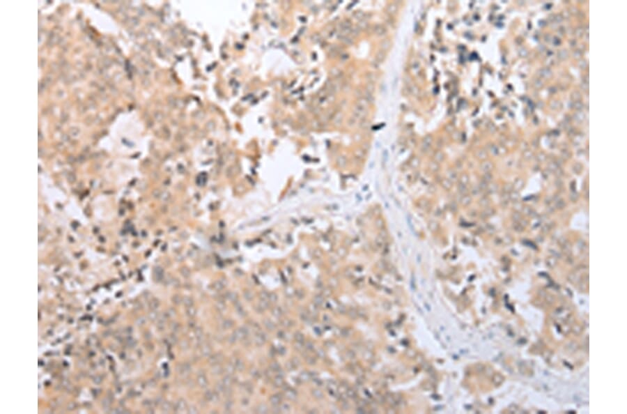 Immunohistochemistry - SLC2A6 Antibody from Signalway Antibody (43276) - Antibodies.com