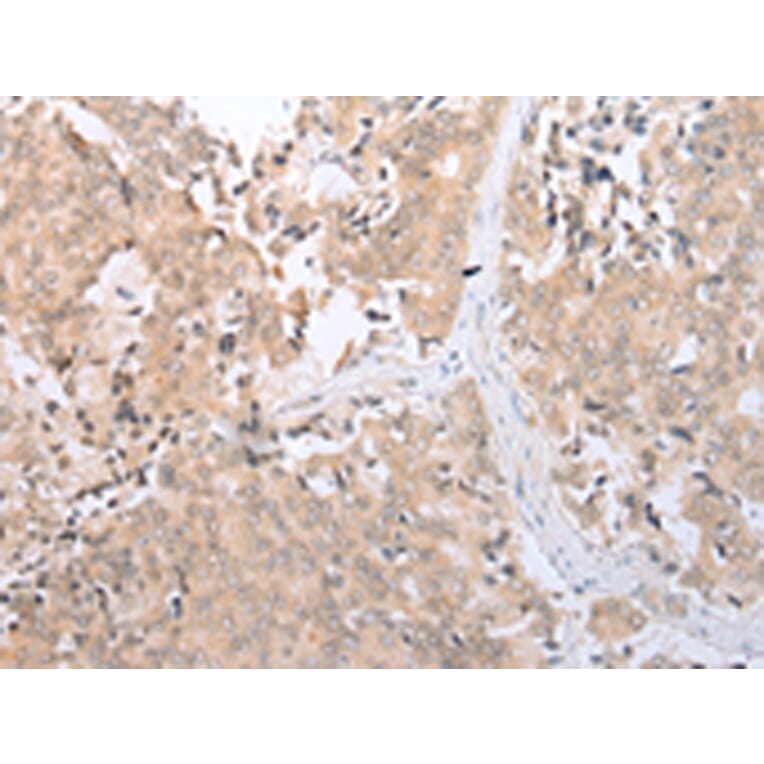 Immunohistochemistry - SLC2A6 Antibody from Signalway Antibody (43276) - Antibodies.com