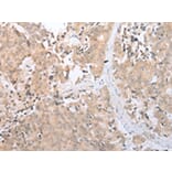 Immunohistochemistry - SLC2A6 Antibody from Signalway Antibody (43276) - Antibodies.com